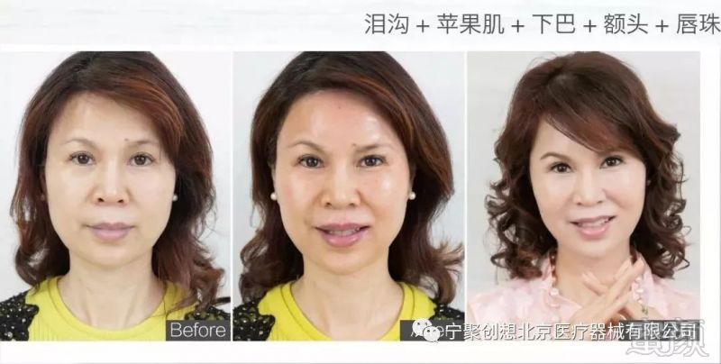 https://img.miyanlife.com/mnt/timg/180227/1145003T0-13.jpg
