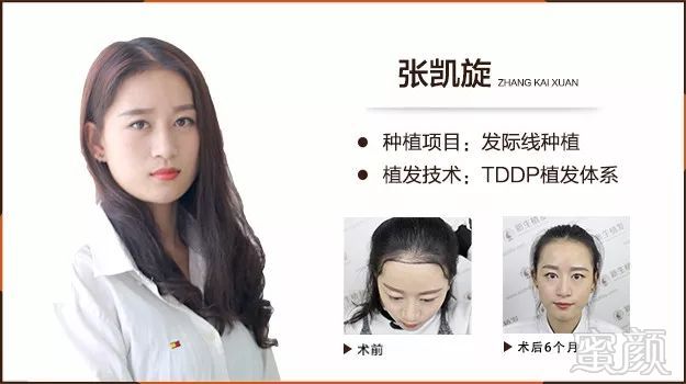 https://img.miyanlife.com/mnt/timg/180227/1145453228-3.jpg