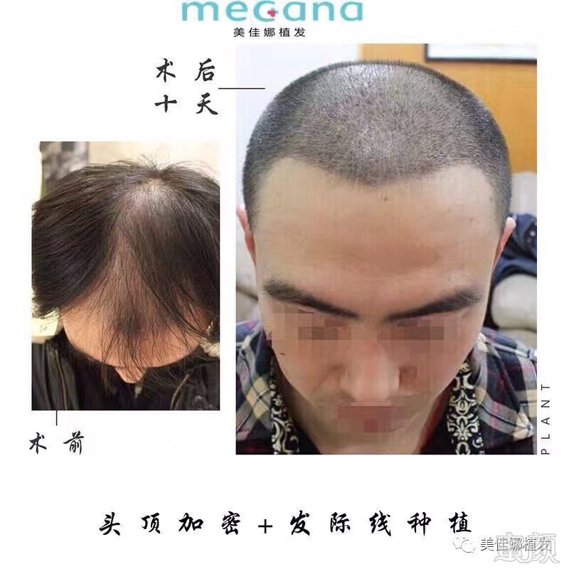 https://img.miyanlife.com/mnt/timg/180227/114Z64641-5.jpg