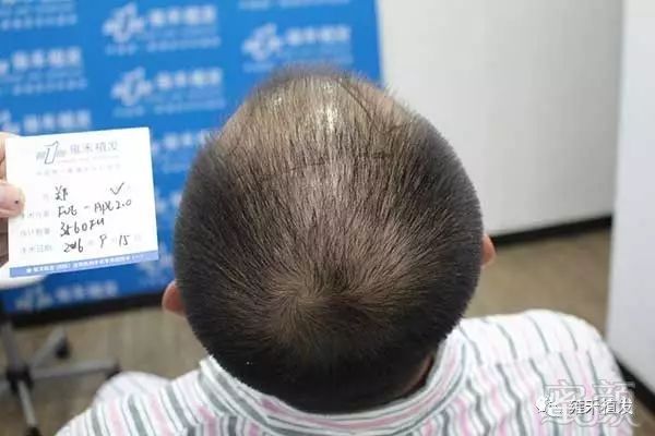 https://img.miyanlife.com/mnt/timg/180227/115502KM-2.jpg