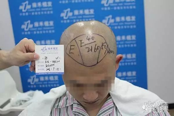 https://img.miyanlife.com/mnt/timg/180227/1155032G2-4.jpg