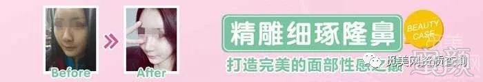 https://img.miyanlife.com/mnt/timg/180227/123232J09-1.jpg