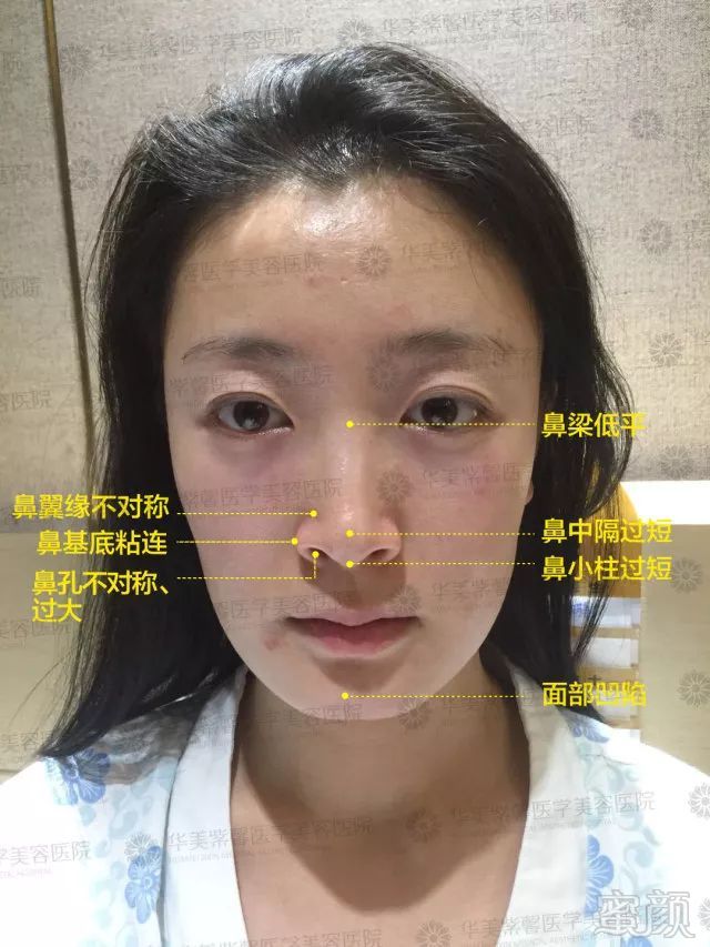 https://img.miyanlife.com/mnt/timg/180227/1250094196-2.jpg