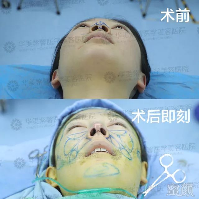 https://img.miyanlife.com/mnt/timg/180227/12501254O-9.jpg