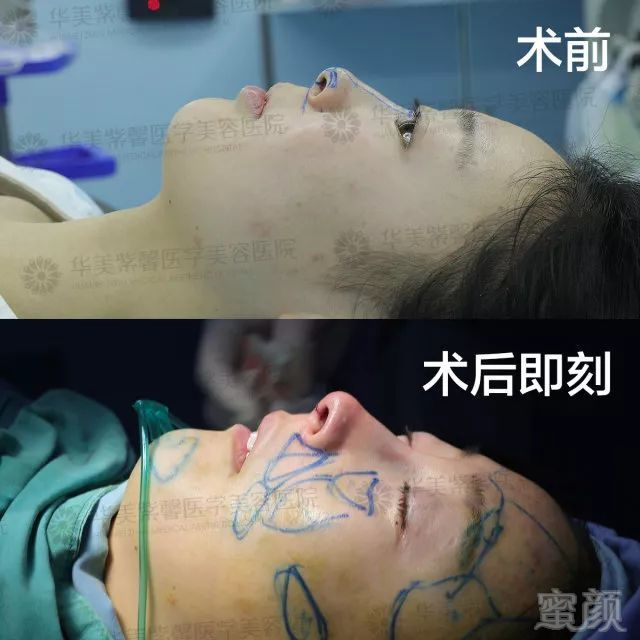 https://img.miyanlife.com/mnt/timg/180227/125012N91-8.jpg