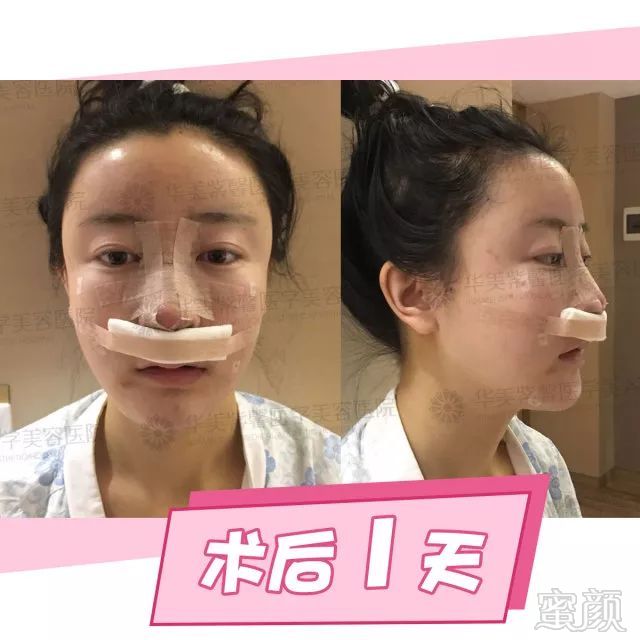 https://img.miyanlife.com/mnt/timg/180227/12501344F-10.jpg