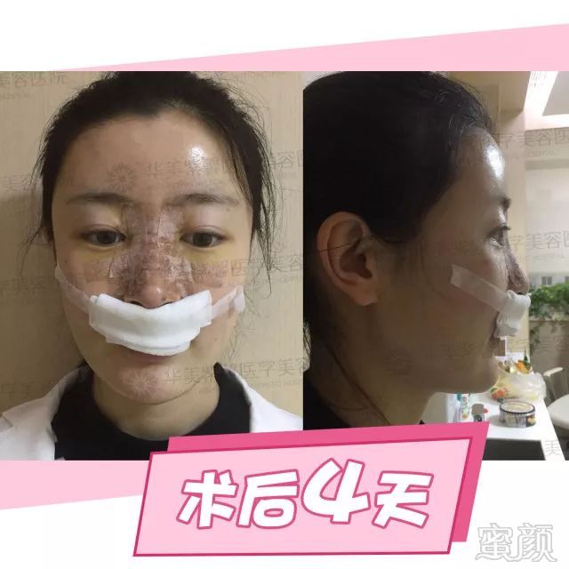 https://img.miyanlife.com/mnt/timg/180227/12501K055-12.jpg