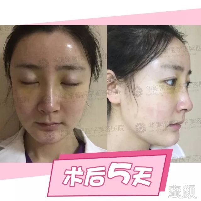 https://img.miyanlife.com/mnt/timg/180227/12501L632-13.jpg