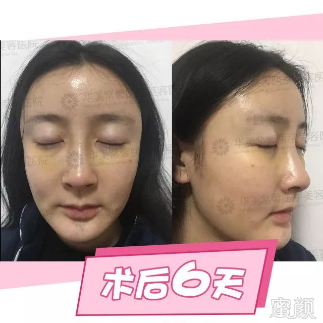 https://img.miyanlife.com/mnt/timg/180227/12501Q256-14.jpg