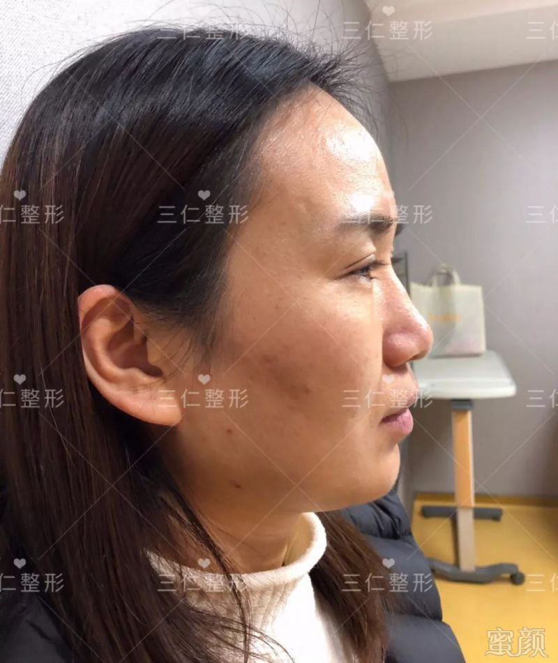 https://img.miyanlife.com/mnt/timg/180227/1251192W5-2.jpg