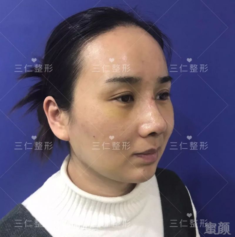 https://img.miyanlife.com/mnt/timg/180227/1251225503-4.jpg
