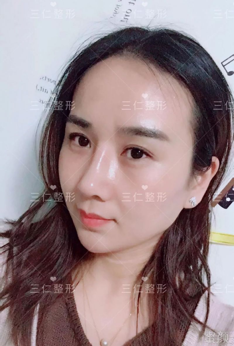 https://img.miyanlife.com/mnt/timg/180227/125130P00-9.jpg