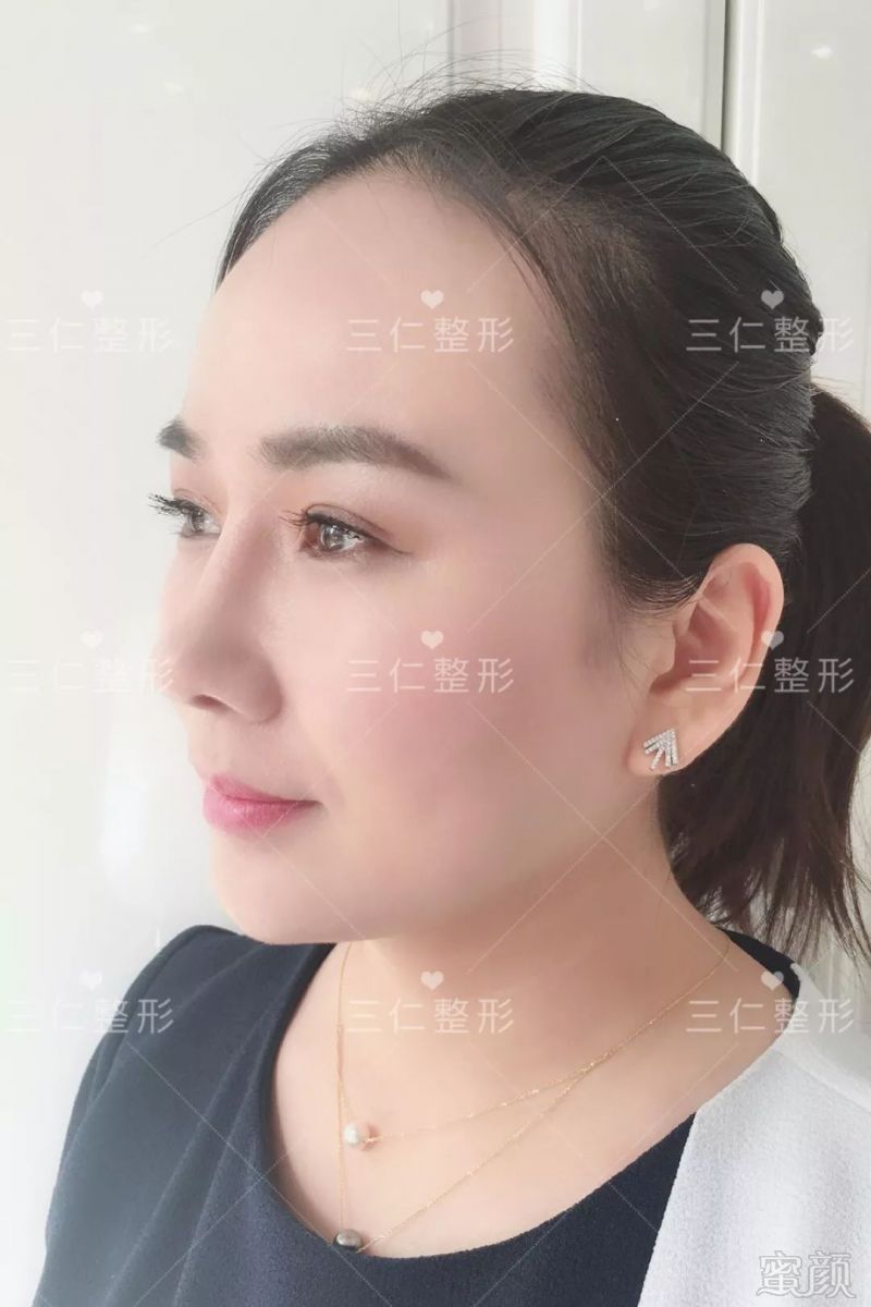 https://img.miyanlife.com/mnt/timg/180227/1251333200-10.jpg