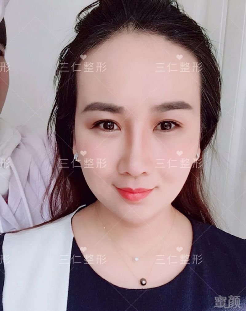 https://img.miyanlife.com/mnt/timg/180227/125134GZ-11.jpg