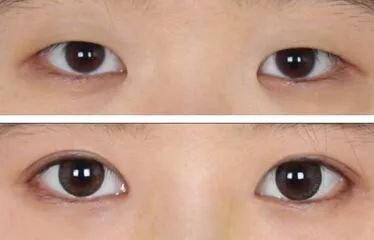 https://img.miyanlife.com/mnt/timg/180227/1310421S4-5.jpg