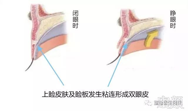 https://img.miyanlife.com/mnt/timg/180227/1313262W4-2.jpg