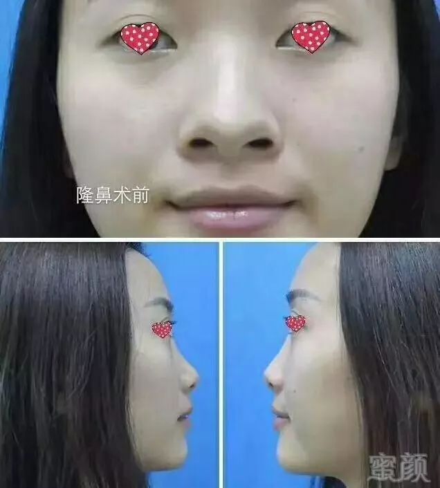 https://img.miyanlife.com/mnt/timg/180228/11415435C-3.jpg
