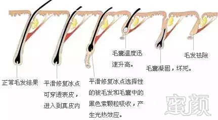 https://img.miyanlife.com/mnt/timg/180228/1151304B5-3.jpg