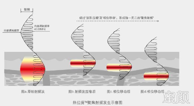 案例图片