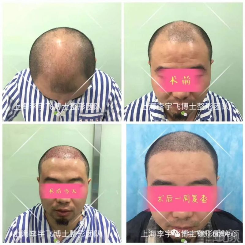 https://img.miyanlife.com/mnt/timg/180228/125203O61-0.jpg