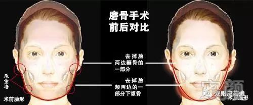 https://img.miyanlife.com/mnt/timg/180228/1256114M8-0.jpg