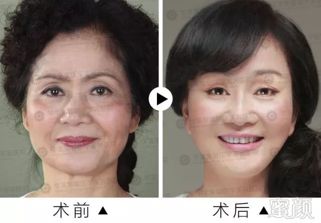 https://img.miyanlife.com/mnt/timg/180228/13262B450-0.jpg