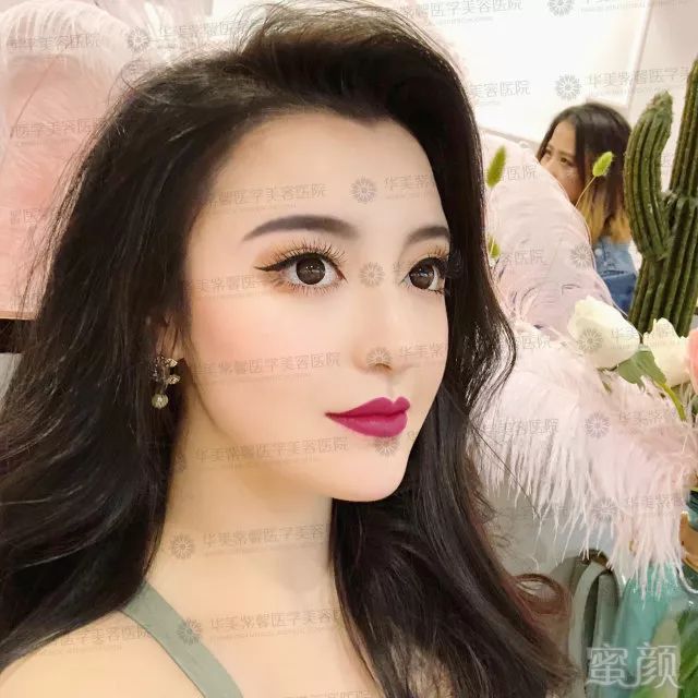 https://img.miyanlife.com/mnt/timg/180228/13262L146-2.jpg