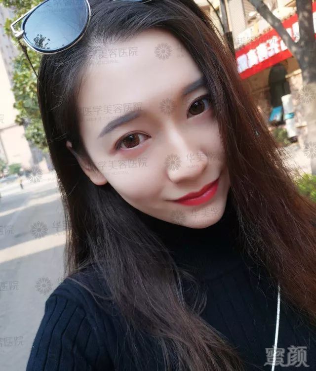 https://img.miyanlife.com/mnt/timg/180228/13262R363-3.jpg