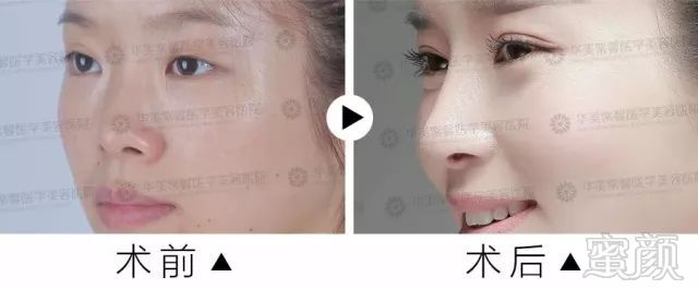 https://img.miyanlife.com/mnt/timg/180228/1326303415-7.jpg