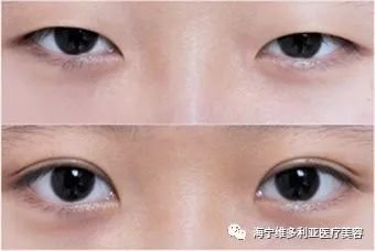 https://img.miyanlife.com/mnt/timg/180301/11300V095-11.jpg