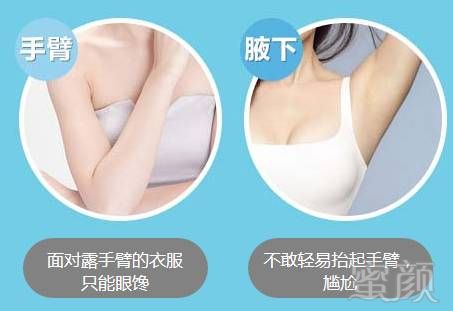 https://img.miyanlife.com/mnt/timg/180301/115P5FM-2.jpg