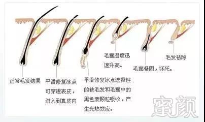 https://img.miyanlife.com/mnt/timg/180301/115RS061-3.jpg