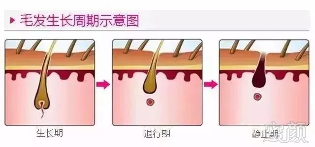 https://img.miyanlife.com/mnt/timg/180301/115RS260-4.jpg