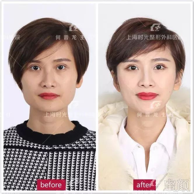 https://img.miyanlife.com/mnt/timg/180301/12002355D-3.jpg