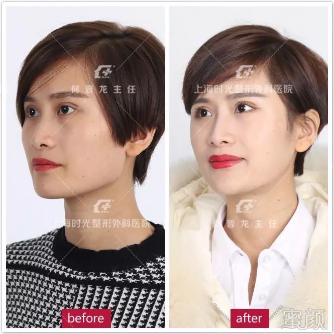 https://img.miyanlife.com/mnt/timg/180301/120023N20-4.jpg