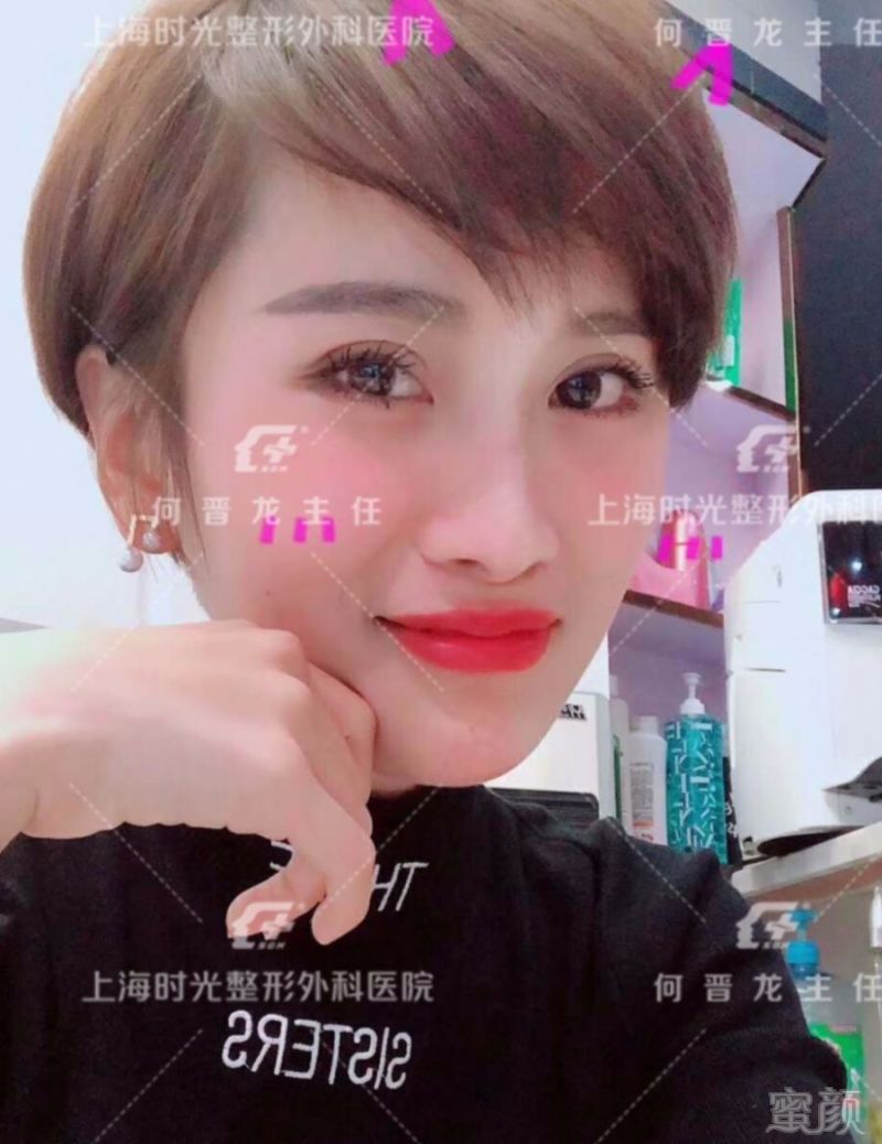 https://img.miyanlife.com/mnt/timg/180301/1200244262-6.jpg