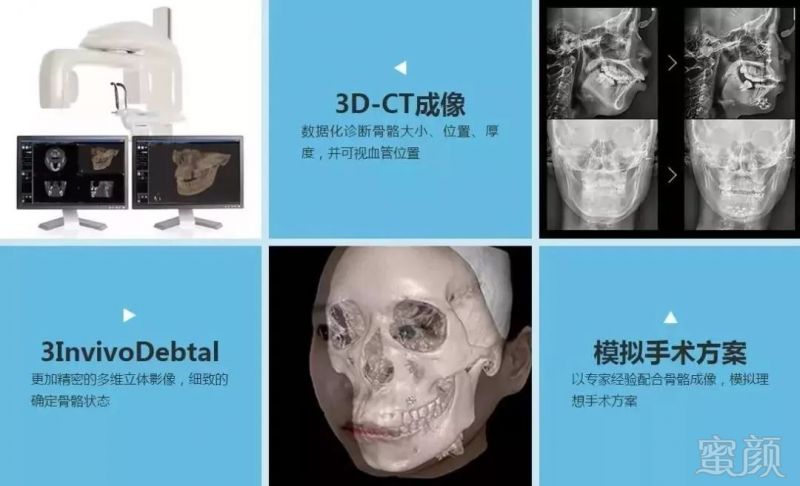 https://img.miyanlife.com/mnt/timg/180301/12002511J-9.jpg