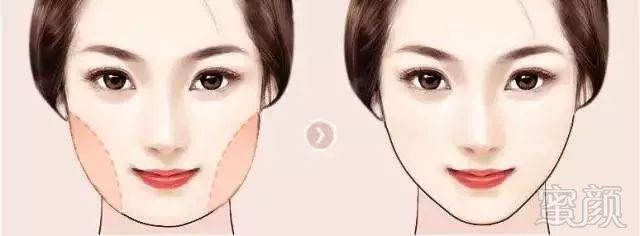 https://img.miyanlife.com/mnt/timg/180301/1200262N6-11.jpg