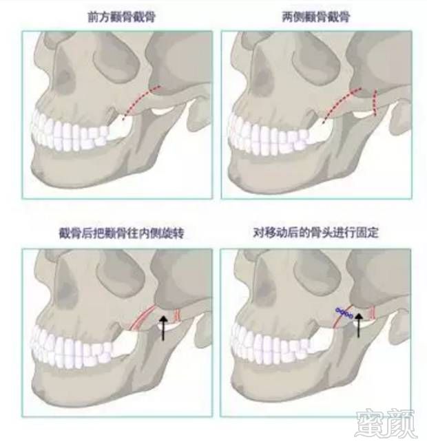 案例图片