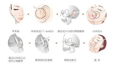 案例图片