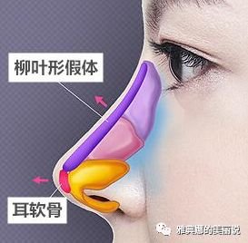 https://img.miyanlife.com/mnt/timg/180301/121FGL1-0.jpg