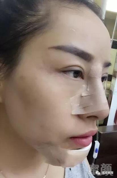 https://img.miyanlife.com/mnt/timg/180301/121T4I10-1.jpg