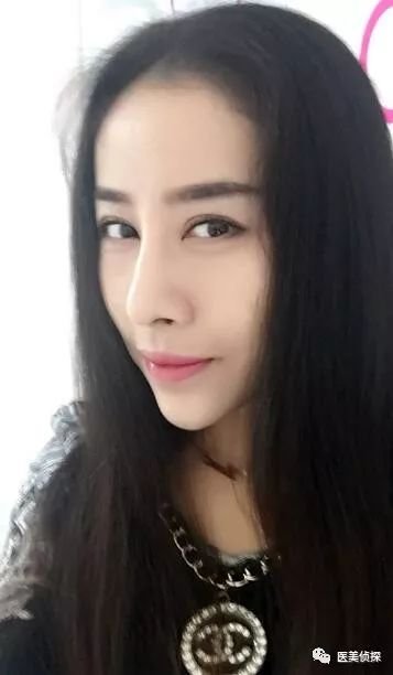 https://img.miyanlife.com/mnt/timg/180301/121U044B-9.jpg