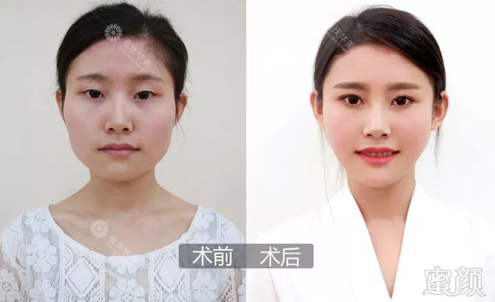 https://img.miyanlife.com/mnt/timg/180301/1230591Q2-2.jpg