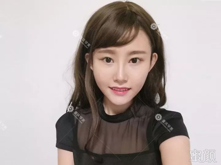 https://img.miyanlife.com/mnt/timg/180301/1231002134-5.jpg
