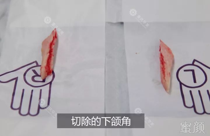https://img.miyanlife.com/mnt/timg/180301/1231012C8-10.jpg
