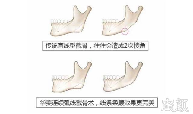 https://img.miyanlife.com/mnt/timg/180301/1231024104-12.jpg