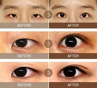 https://img.miyanlife.com/mnt/timg/180301/123RT959-7.jpg