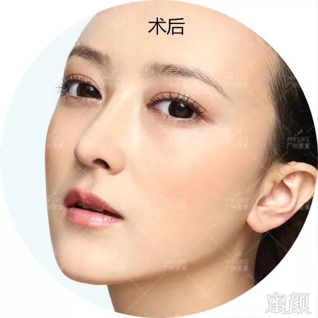 https://img.miyanlife.com/mnt/timg/180301/1255014T9-7.jpg