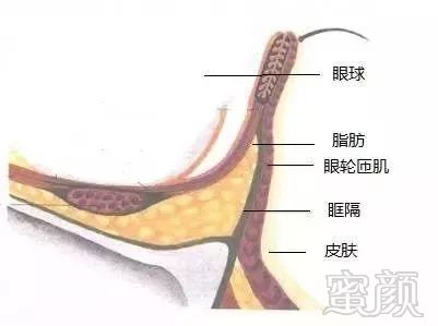 案例图片